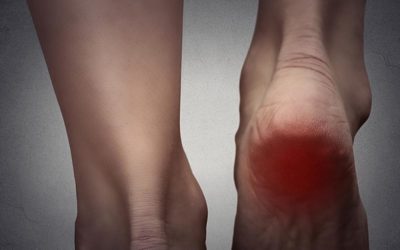 Why Your Heel Hurts in the Morning